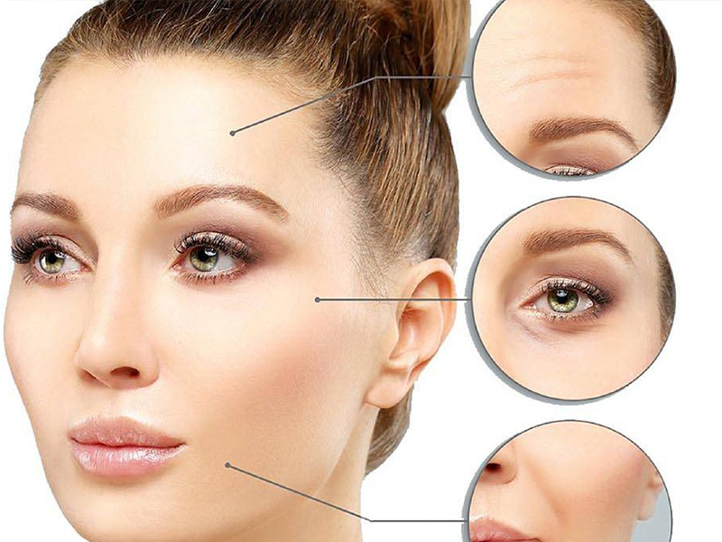 تزريق ژل و بوتاکس